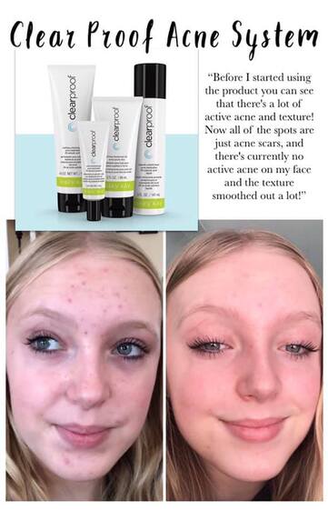 CLEAR PROOF ACNE SYSTEM SET SKIN CARE COLLECTION